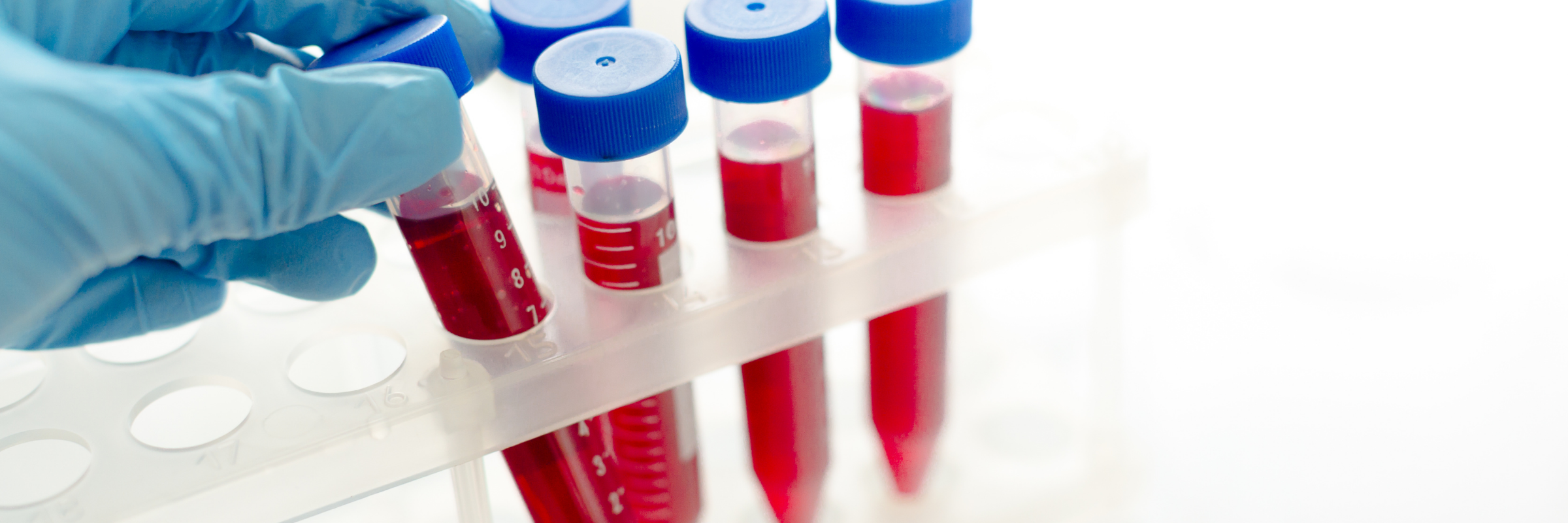 Anémie : l'anémie et ses risques